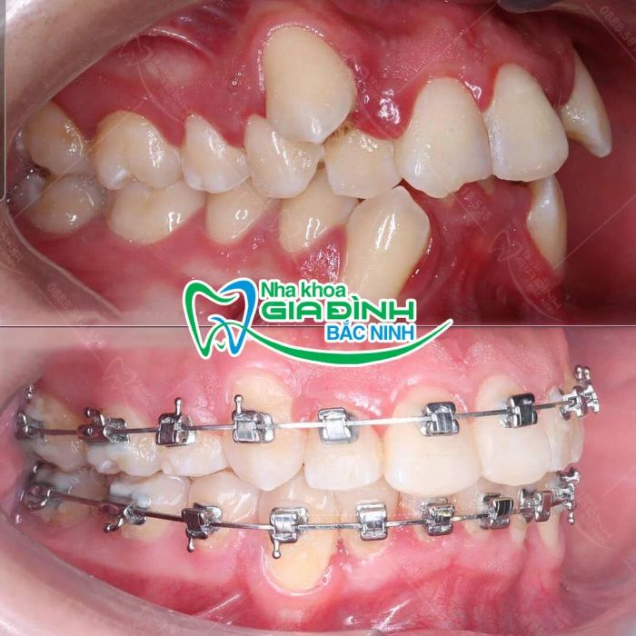 Hình ảnh không gian hiện đại tại Nha Khoa Gia Đình Bắc Ninh