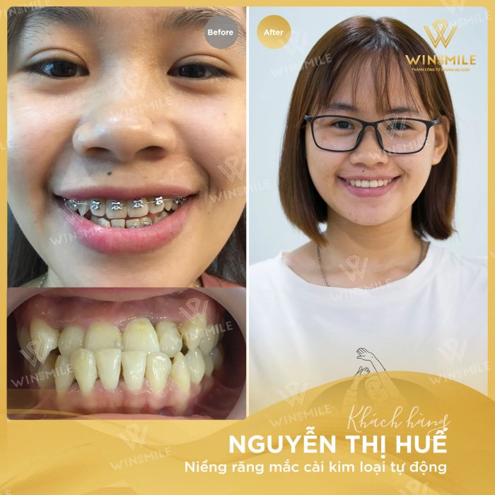 Hình ảnh cơ sở vật chất hiện đại tại Nha Khoa Win Smile