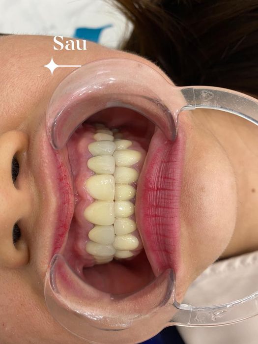 Hình ảnh thực tế về không gian hiện đại tại Nha Khoa Dr. Xuân Thủy