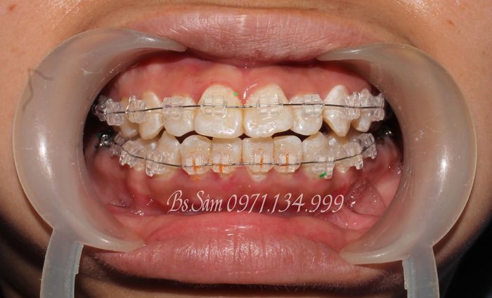 Hệ thống trang thiết bị tối tân tại Nha khoa Tâm Thiện Mỹ