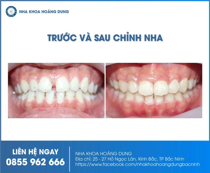 Hình ảnh phòng khám hiện đại tại Nha Khoa Hoàng Dung Bắc Ninh