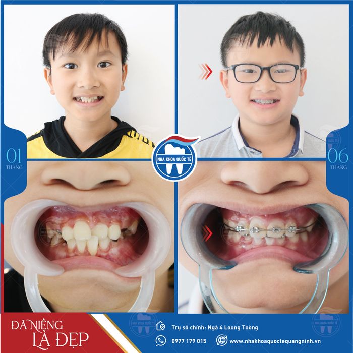 Hình ảnh phòng khám tiêu chuẩn 5 sao tại Nha Khoa Quốc Tế Quảng Ninh