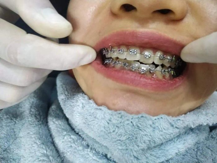 Khám phá không gian hiện đại và dịch vụ chuyên nghiệp tại Nha Khoa Thẩm Mỹ Công Phúc qua loạt ảnh chất lượng cao.