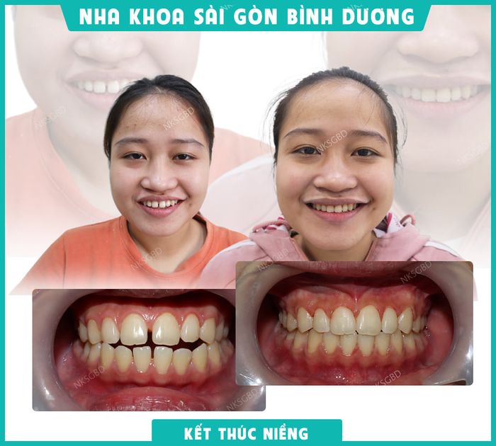 Hình ảnh thực tế tại Nha khoa Sài Gòn Bình Dương - Ảnh 2