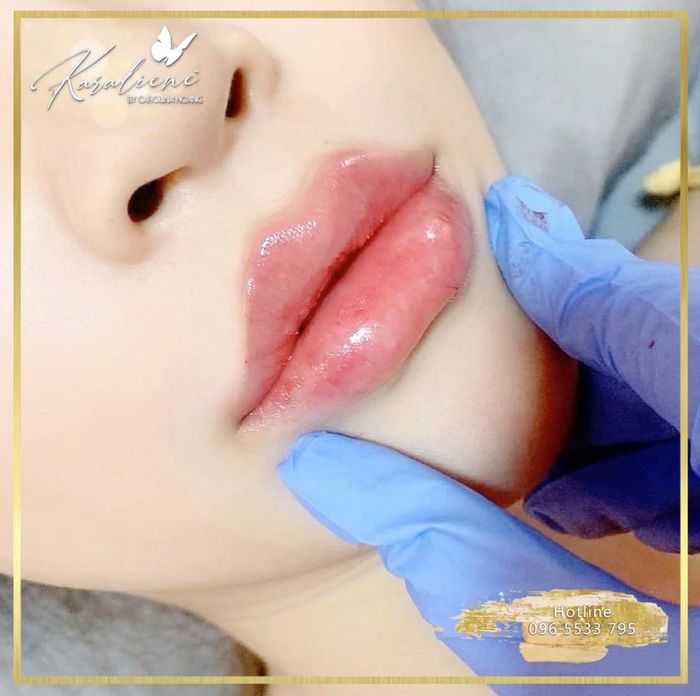 Không gian hiện đại và tiện nghi tại Karalienè - Thẩm Mỹ Filler Nha Trang
