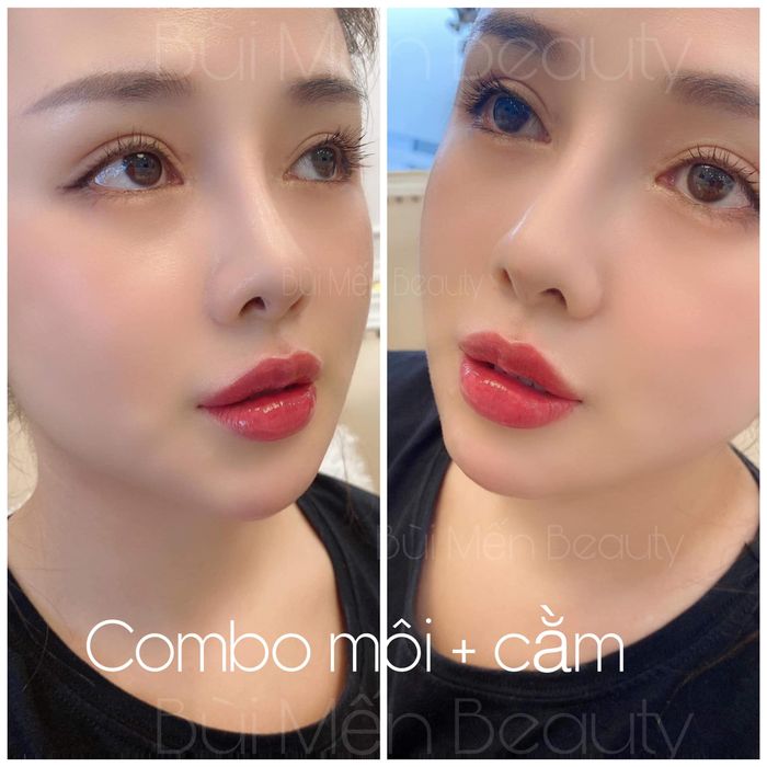 Phòng tiêm chuẩn y khoa hiện đại tại Bùi Mến Beauty