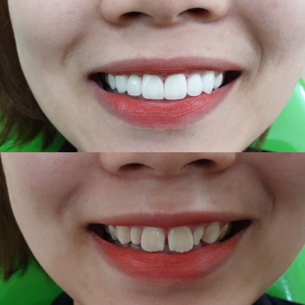 Không gian hiện đại tại Nha Khoa VinSmile Bắc Ninh