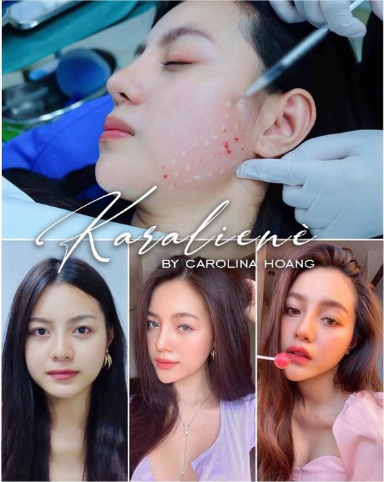 Không gian sang trọng và chuyên nghiệp tại Karalienè - Thẩm Mỹ Filler Nha Trang