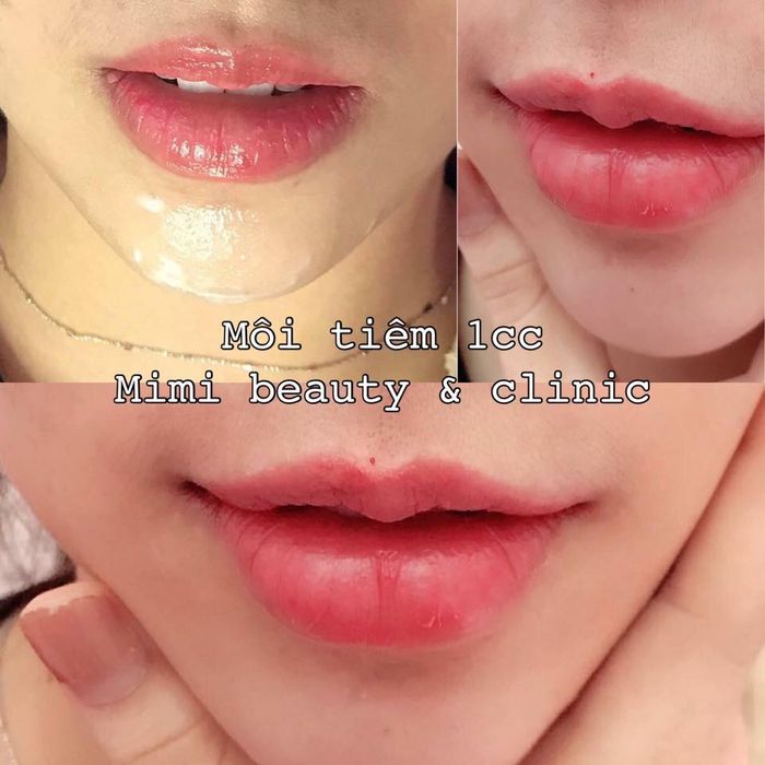 Không gian sang trọng và hiện đại tại MiMi Beauty & Clinic