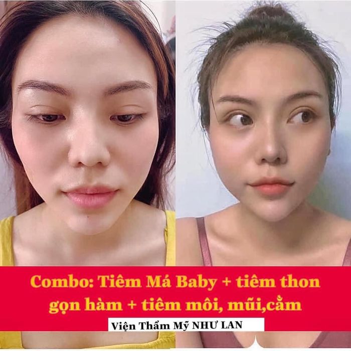 Không gian hiện đại và chuyên nghiệp tại Viện Thẩm Mỹ Như Lan