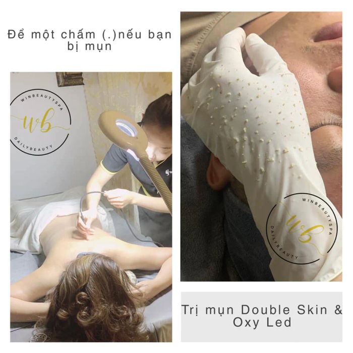 Trải nghiệm dịch vụ cao cấp tại WinBeauty Spa