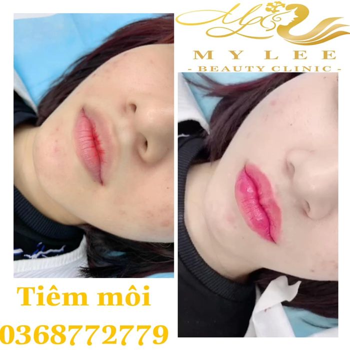 Không gian hiện đại và tiện nghi tại MY LEE Beauty Clinic