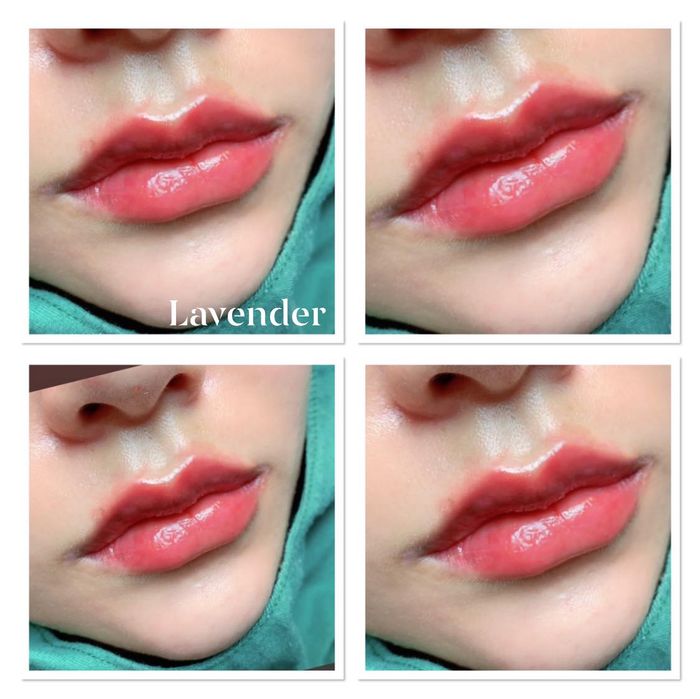 Phòng tiêm chuẩn y khoa tại Lybeauty (Lavender)