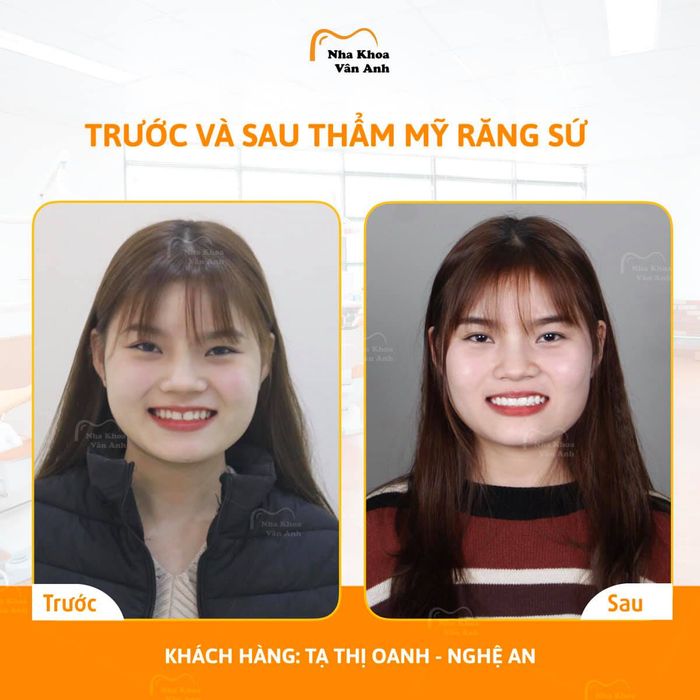 Không gian hiện đại tại Nha khoa Vân Anh