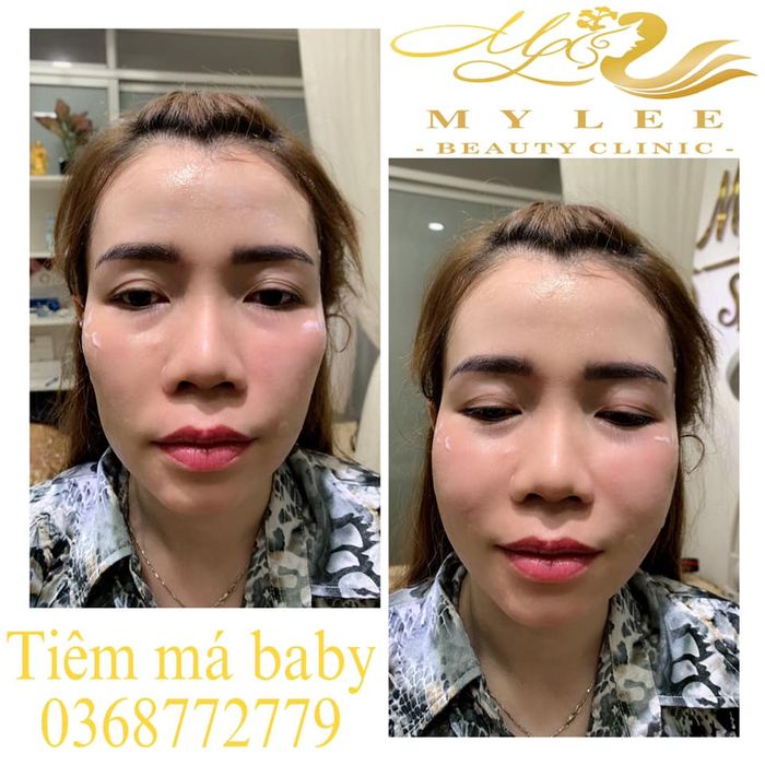 Không gian sang trọng và hiện đại tại MY LEE Beauty Clinic