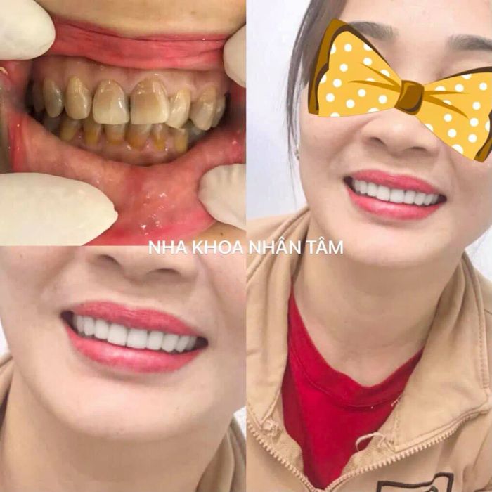 Nha Khoa Nhân Tâm ảnh 2