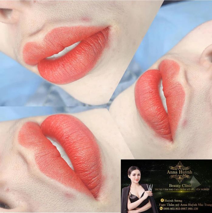 Thẩm mỹ Anna Huỳnh Nha Trang ảnh 1
