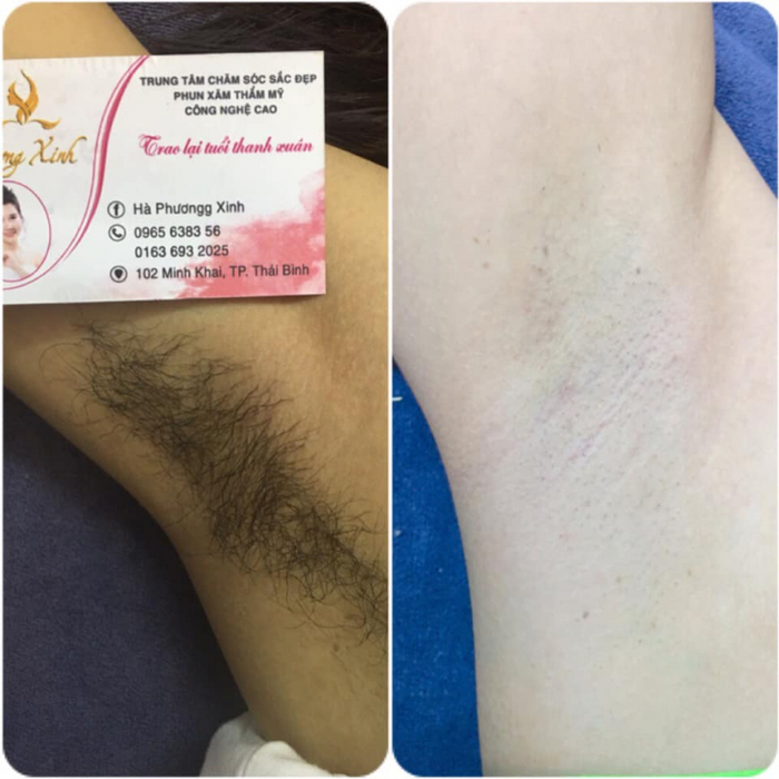 Phương Xinh Spa hình ảnh 2