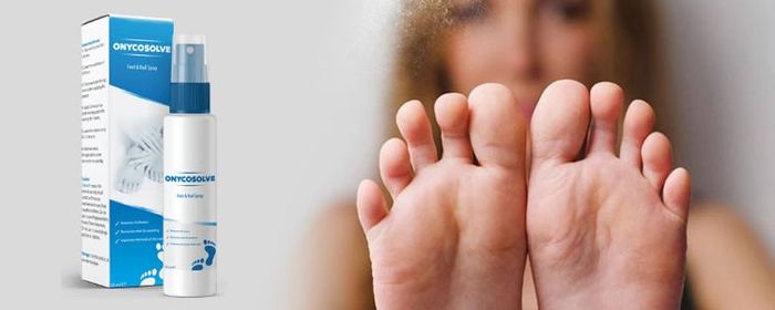 Hình ảnh minh họa sản phẩm OnycoSolve - giải pháp xịt trị nấm toàn diện