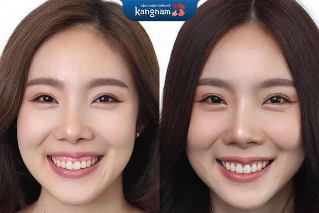 Hình ảnh phòng phẫu thuật hiện đại tại Bệnh viện Thẩm mỹ Kangnam