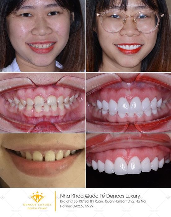 Hình ảnh phòng điều trị cao cấp tại Dencos Luxury