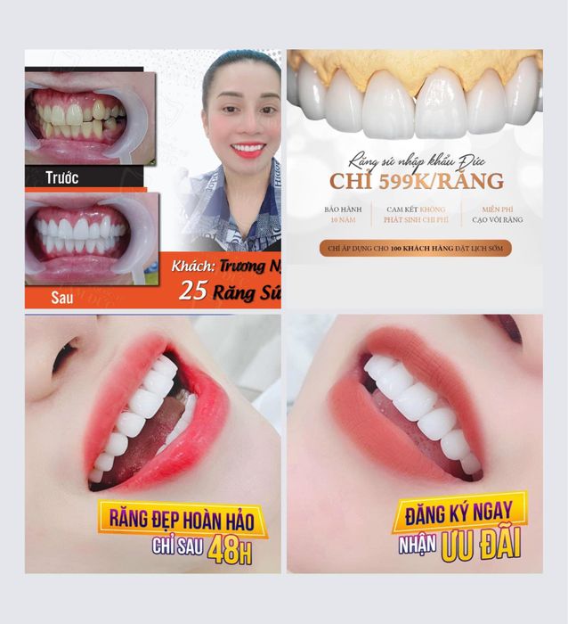 Hình ảnh thực tế về quy trình điều trị tại Nha Khoa Long Sài Gòn