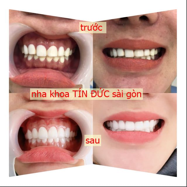 Hình ảnh công nghệ điều trị hiện đại tại Nha Khoa Tín Đức