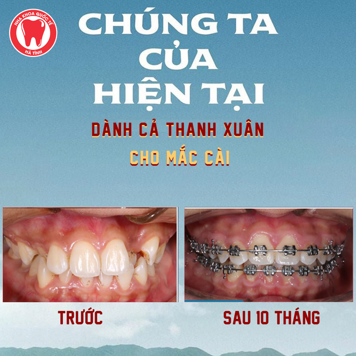 Không gian hiện đại tại Phòng khám Nha Khoa Quốc Tế