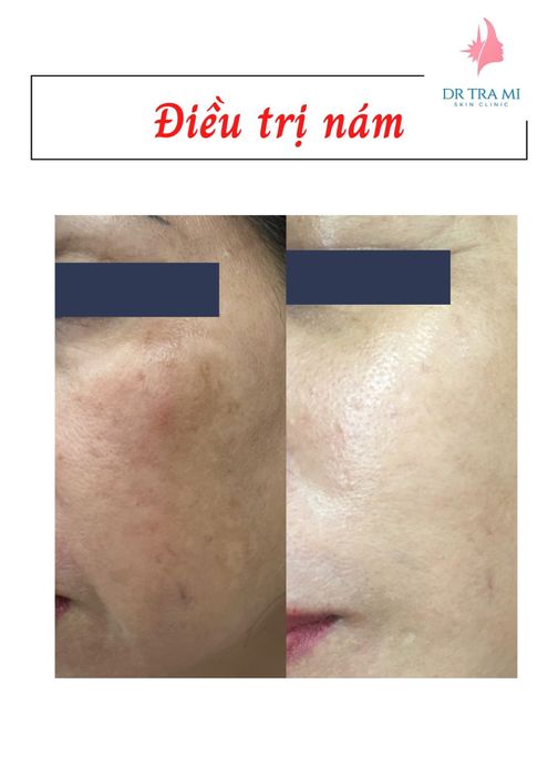 Hình ảnh thực tế Phòng Khám Bác Sĩ CKII Da Liễu Nguyễn Lê Trà Mi