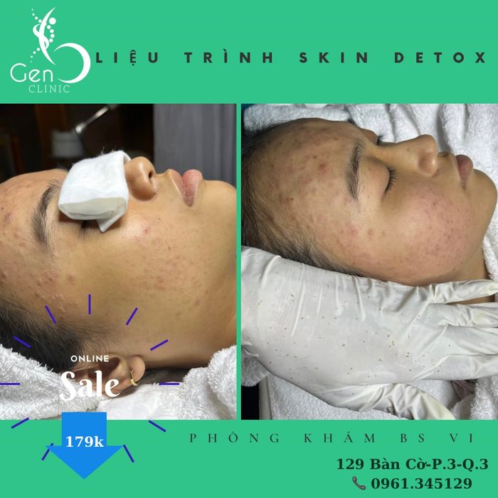 Hình ảnh thực tế về quy trình điều trị tại Phòng Khám BS Lê Thượng Thụy Vi