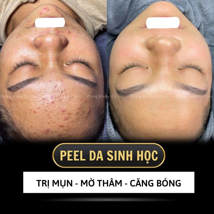 Hình ảnh thực tế Phòng Khám Da Liễu Q Clinic