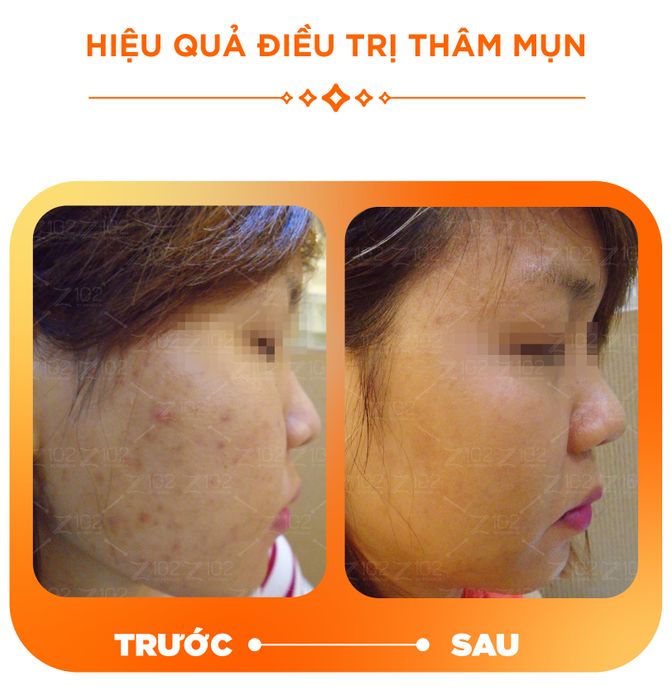 Hệ thống máy móc hiện đại tại Phòng khám Da liễu Thẩm mỹ Z102