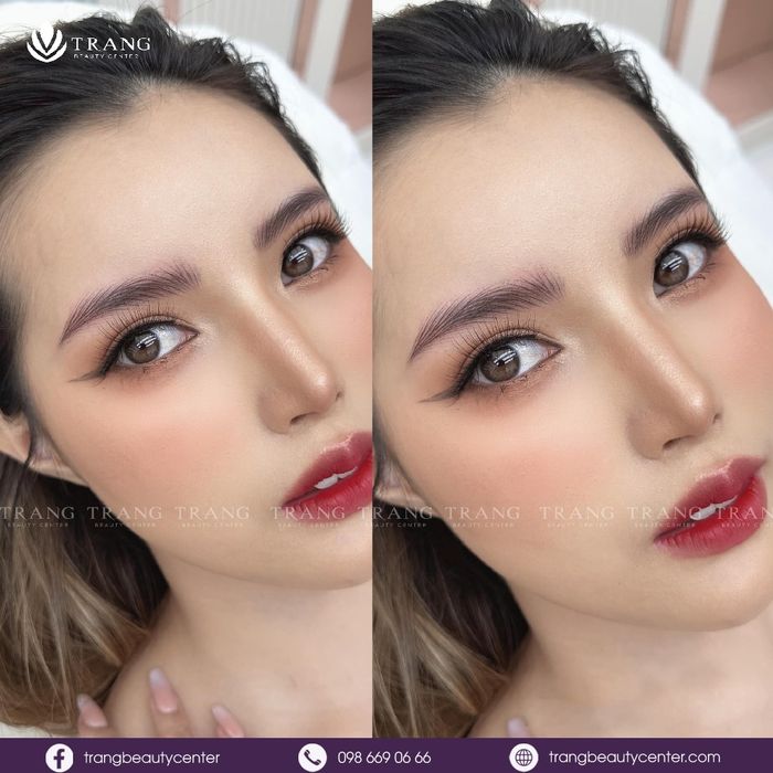 Trang Beauty Center - Ảnh 2