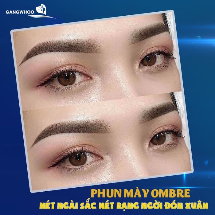 Thẩm Mỹ Viện Gangwhoo - Ảnh 2
