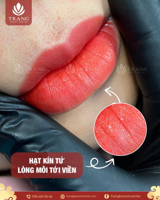 Trang Beauty Center - Ảnh 3