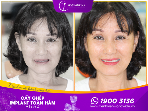 Không gian hiện đại tại Bệnh viện Răng Hàm Mặt - Phẫu thuật Thẩm mỹ Worldwide