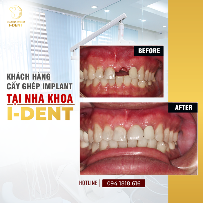 Hình ảnh phòng khám đạt chuẩn quốc tế tại Nha Khoa I-Dent