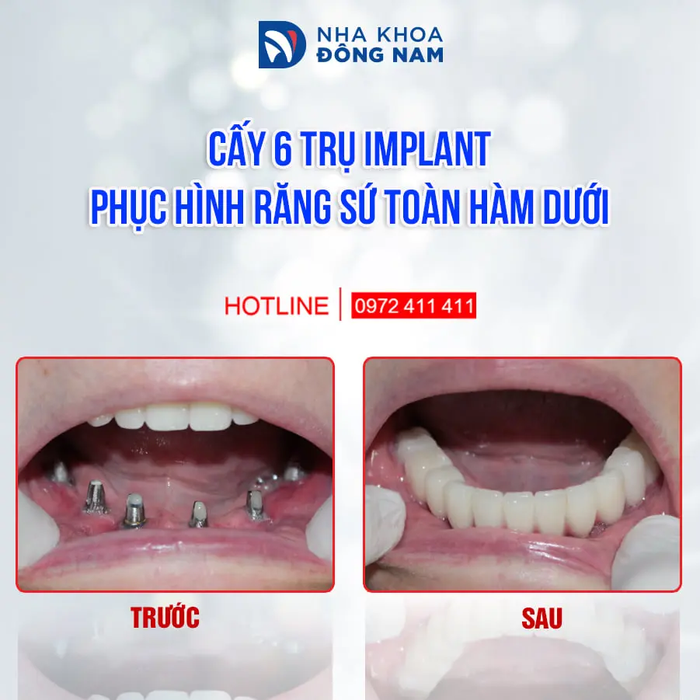 Hình ảnh phòng khám hiện đại đạt chuẩn quốc tế tại Nha khoa Đông Nam