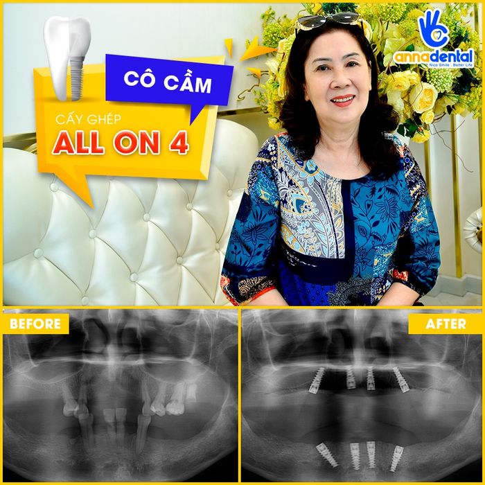 Hình ảnh phòng khám hiện đại đạt chuẩn quốc tế tại Nha Khoa Anna