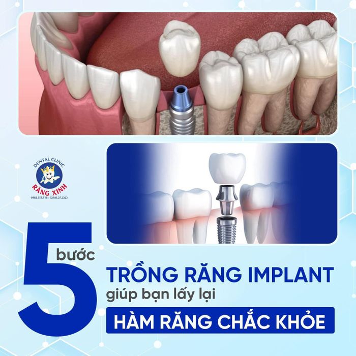 Hình ảnh đội ngũ bác sĩ chuyên nghiệp tại Nha khoa Răng Xinh