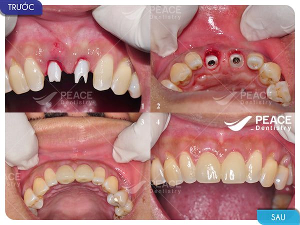 Không gian hiện đại và sang trọng tại Nha khoa Peace Dentistry