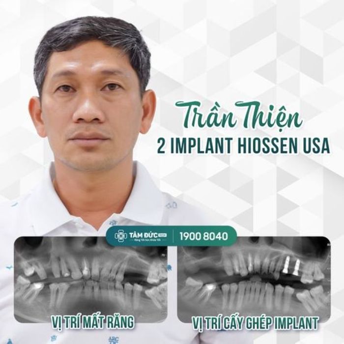Hình ảnh không gian hiện đại tại Viện Cấy Ghép Implant TÂM ĐỨC SMILE