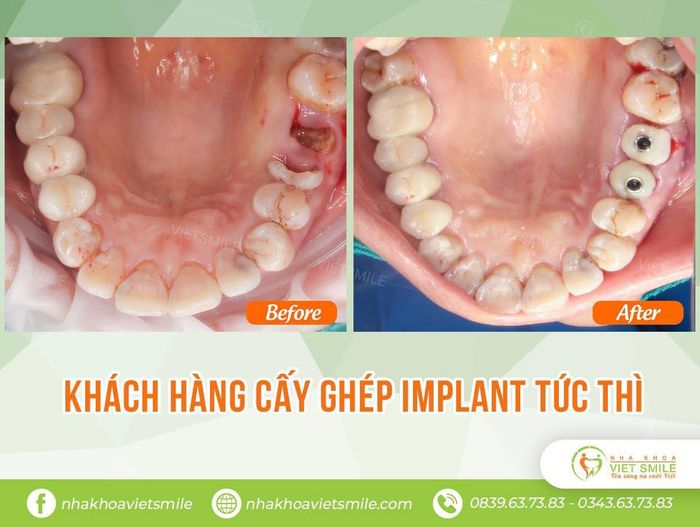 Hình ảnh cơ sở vật chất hiện đại tại Nha khoa Việt Smile