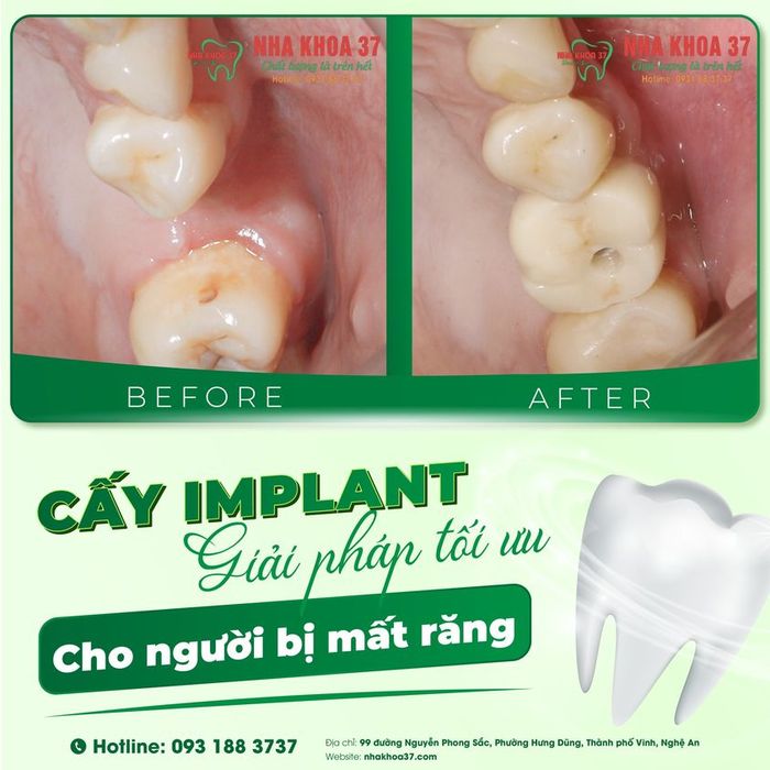 Hình ảnh phòng khám hiện đại tại Nha Khoa 37