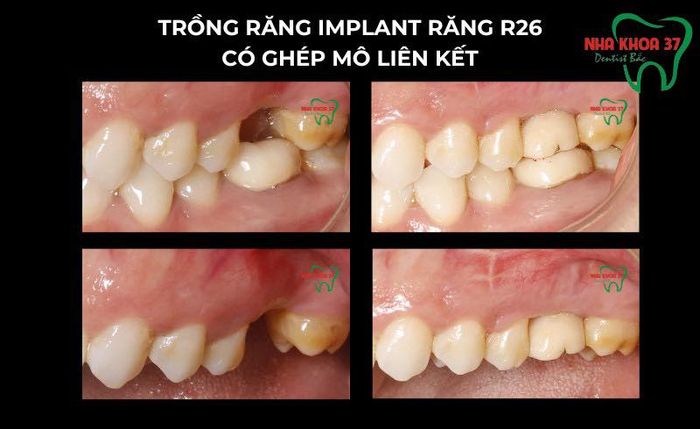 Hình ảnh cơ sở vật chất hiện đại tại Nha Khoa 37