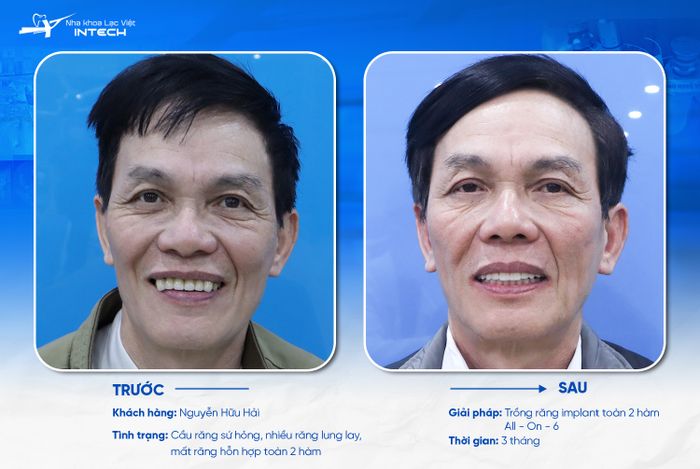 Hình ảnh phòng khám hiện đại tại Nha khoa Lạc Việt Intech