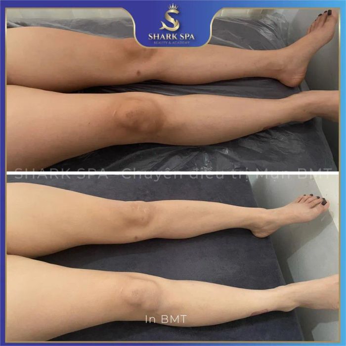 Hình ảnh không gian trị liệu tại SHARK Spa