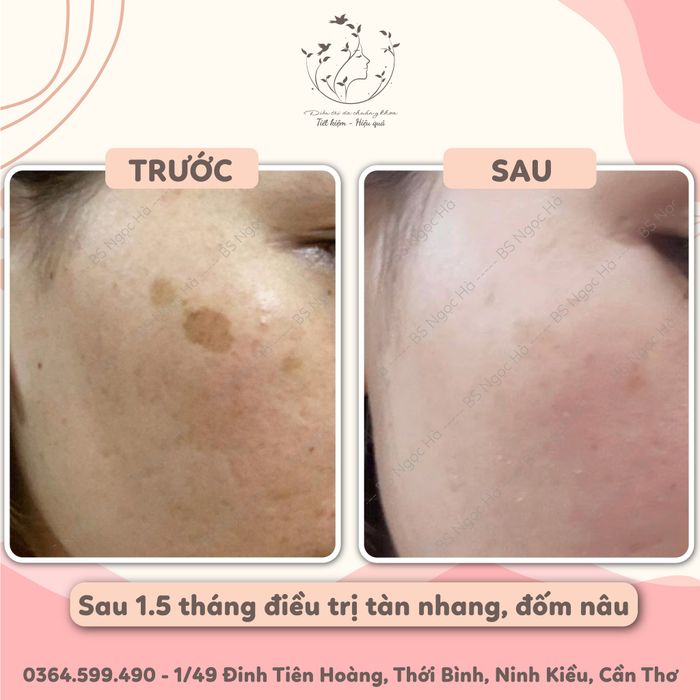 Bác Sĩ Ngọc Hà - Da Liễu Thẩm Mỹ - Không gian điều trị sang trọng