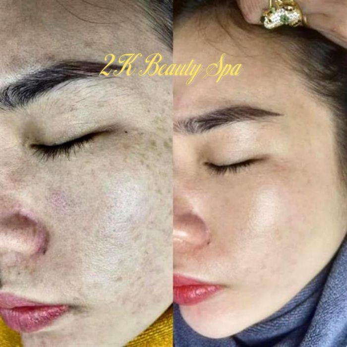 2K Beauty Spa Cần Thơ - Phòng điều trị công nghệ cao