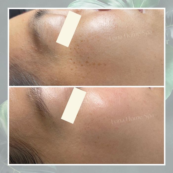 Lona Home Spa - Hệ thống phòng trị liệu tiêu chuẩn 5 sao